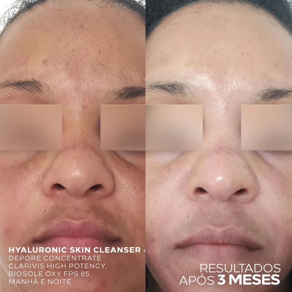 Fluido de Limpeza Facial Ada Tina Hyaluronic Cleanser 100ml
