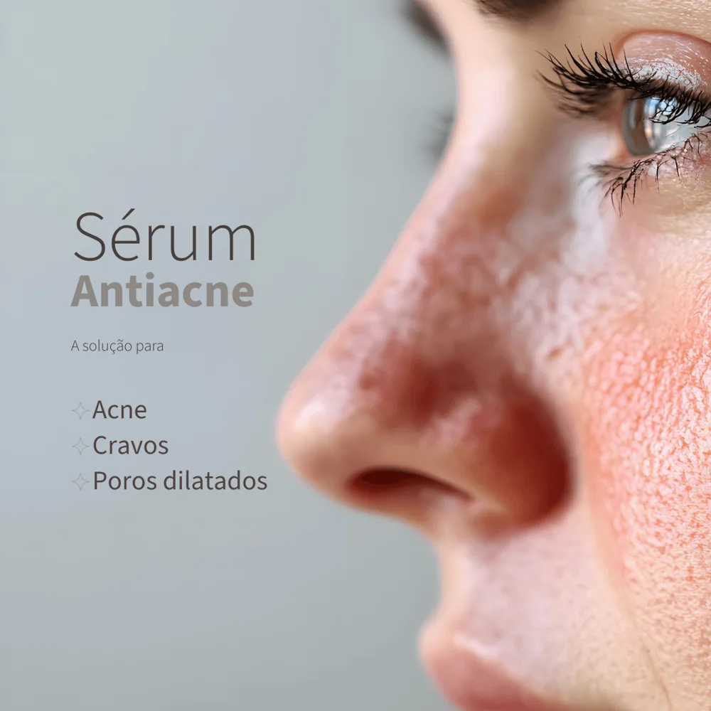 Sérum Antiacne Pele Oleosa