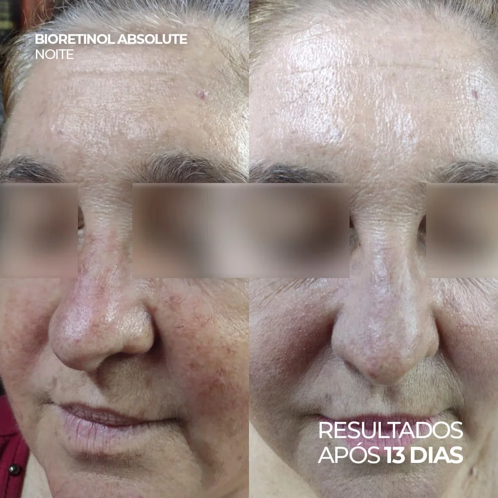 Sérum Bioretinol Absolute High Dose Ada Tina Anti-Idade