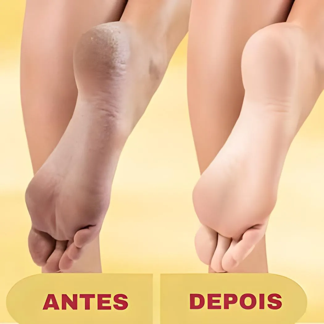 Lixa Elétrica Pés Pedicuro Removedor Calos E Rachaduras + Creme Esfoliante