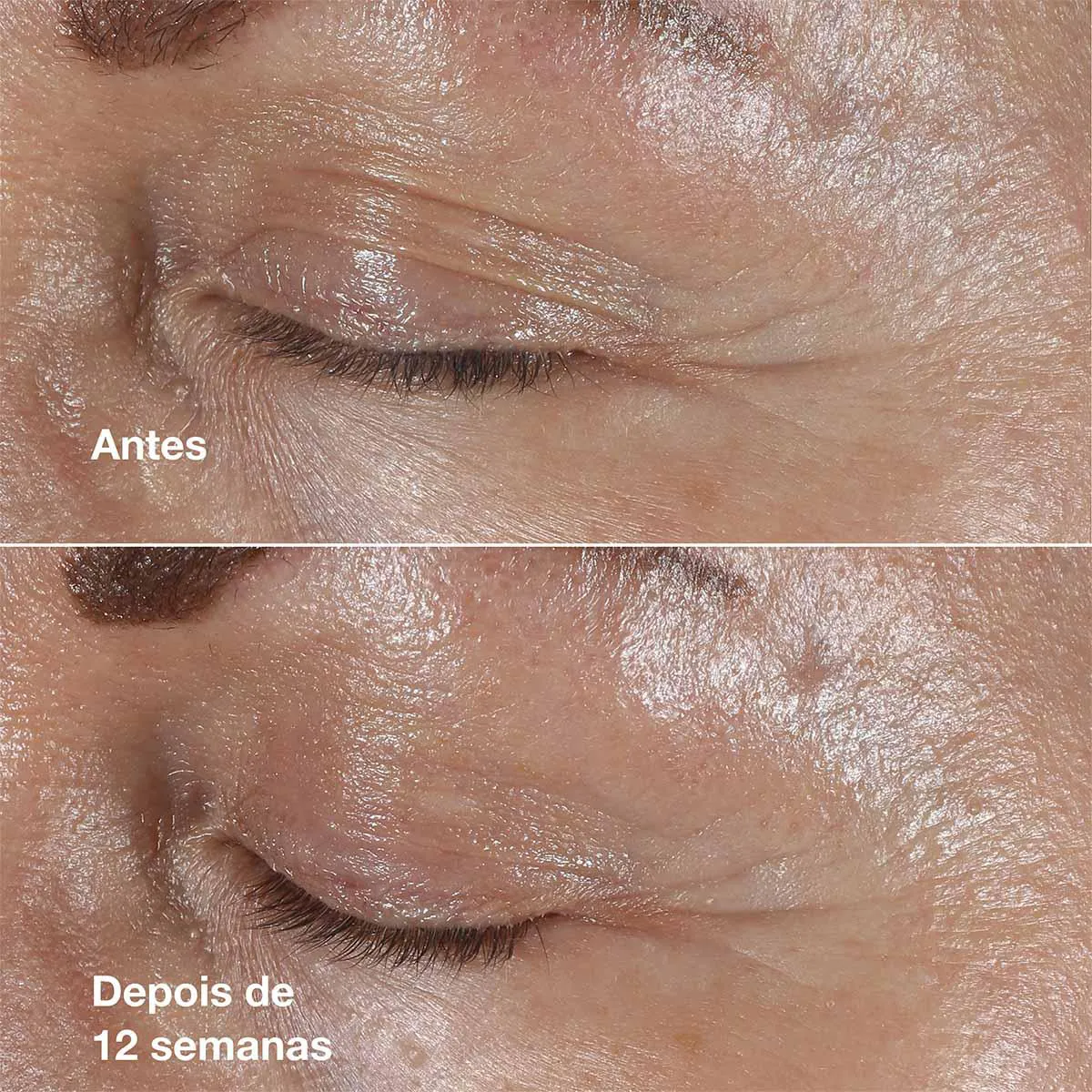 Creme Antirrugas Clinique Smart Repair Para Área dos Olhos 15ml
