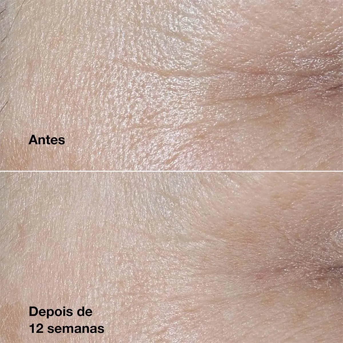 Creme Antirrugas Smart Clinical Repair 50ml