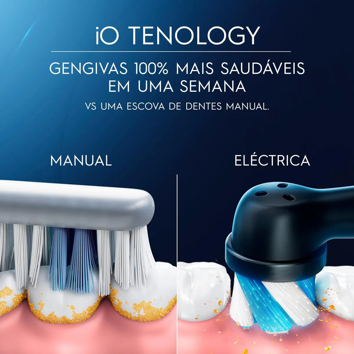 Escova de Dente Elétrica Oral B IO Series 4 1 Cabo + 2 Refis