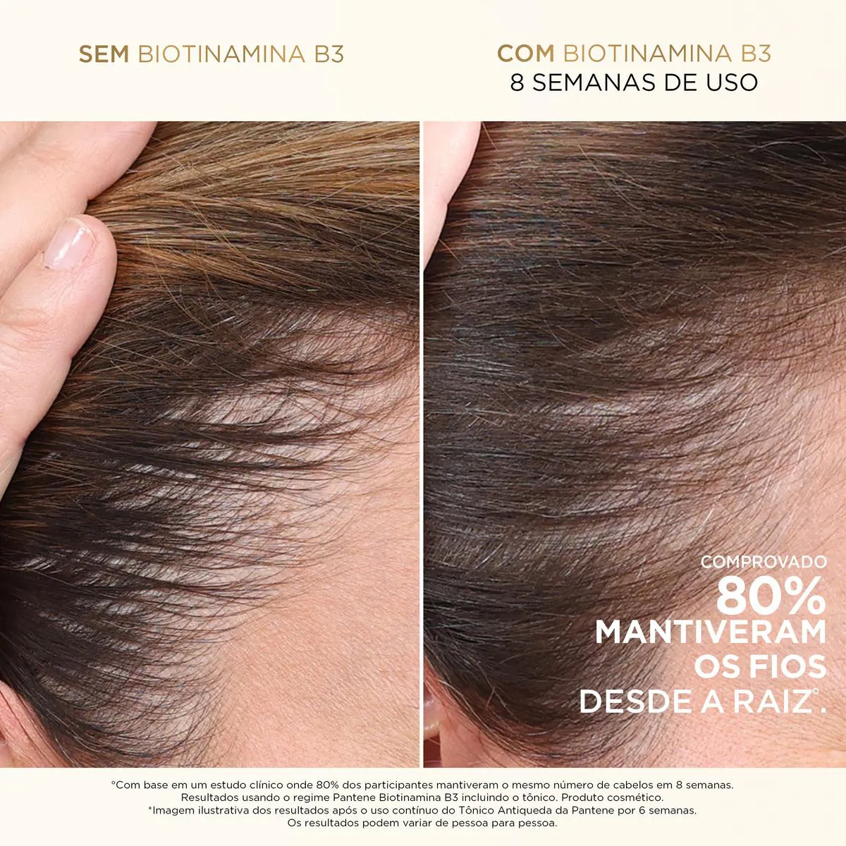 Tônico Capilar Antiqueda Pantene Pro-V Biotinamina B3 52ml